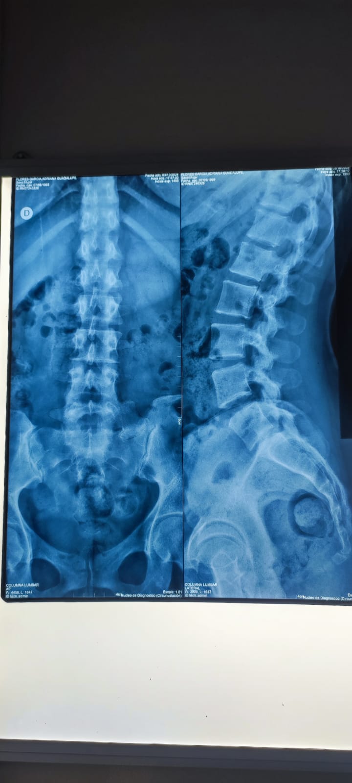 Traumatología y Esguinces
